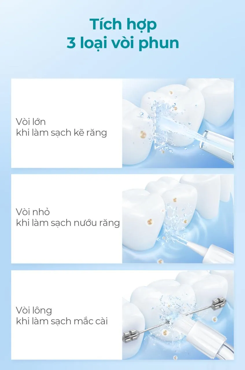 Máy Tăm Nước Sóng Siêu Âm Usmile Màu Green 26 Máy Tăm Nước Sóng Siêu Âm Usmile Màu Green