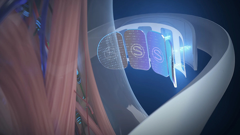 Skg K5-Pro Với 2 Công Nghệ Xung Điện Tens + Ems Đặc Trưng Của Thương Hiệu Skg Giúp Bạn Xóa Tan Trực Tiếp Các Cơn Đau Mỏi 